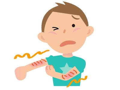 アトピー：eczema のアイキャッチ